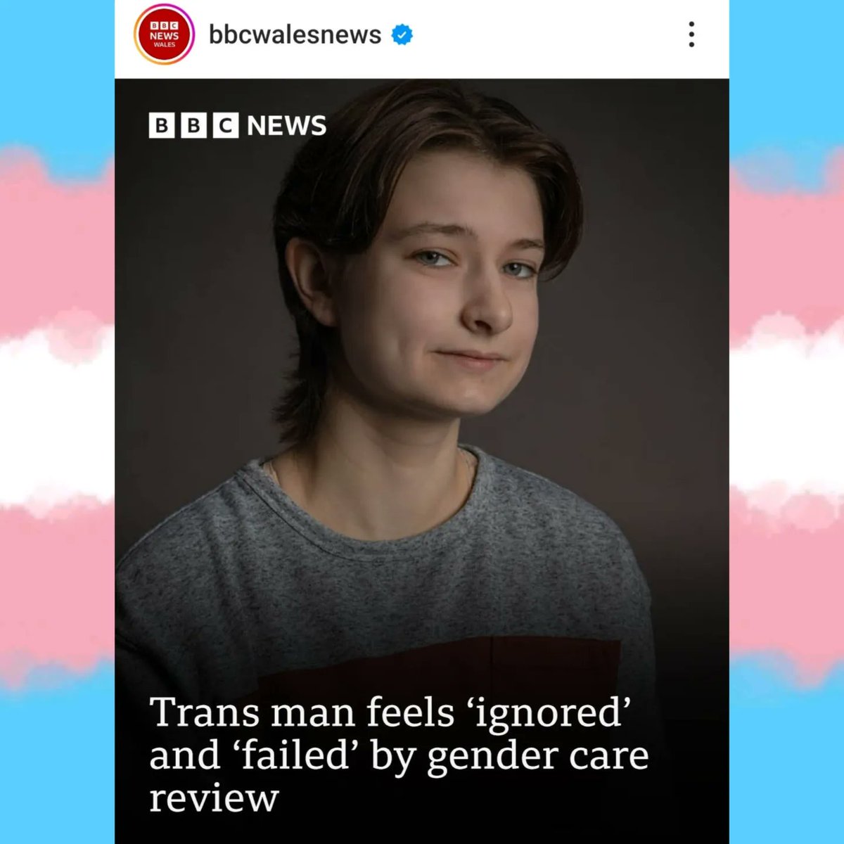 1 year since I started the physical medical transition 🎉

Gender affirming care gave me back a life I didn't think I could have
#Testosterone #HRT #TopSurgery #Trans #TransJoy #Transgender #TransHealthcare #MedicalTransition #GenderAffirmingCare #GenderAffirmingHealthcare