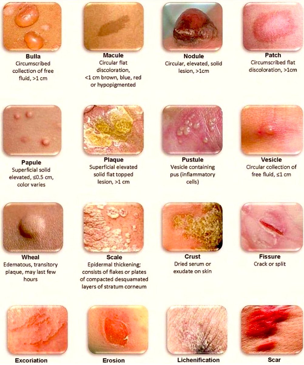 Different skin lesions.