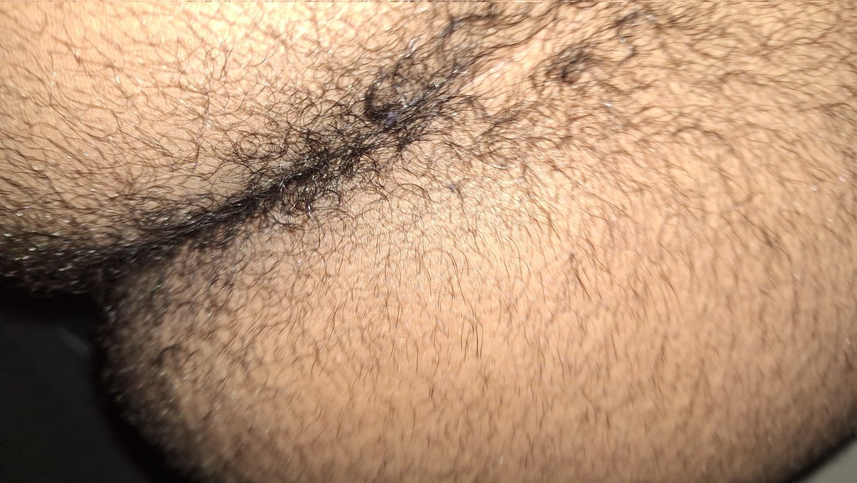 أريد شخص يأكل طيزي المشعر من دون رحمه وما يهم العمر ولا الشكل اهم شي جاد من شرق الرياض وسيارتك مظلله #موجب_الرياض #سالب_الرياض #مبادل_الرياض