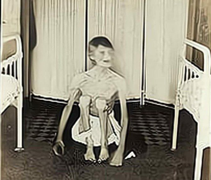 1spiderdan's tweet image. La Mujer que estuvo encerrada en una jaula comprimida por 40 años...

El Horrible Caso de Rhoda Derry 

Abro Hilo 🧵