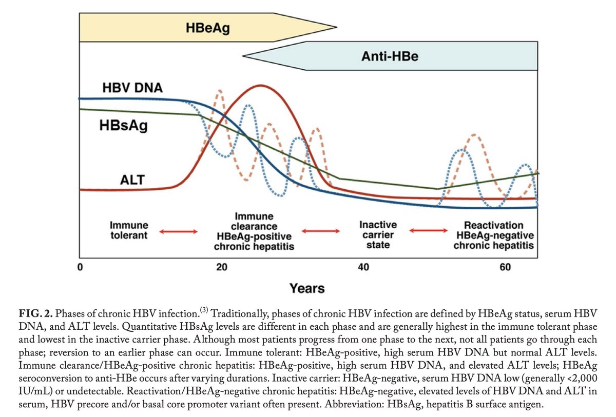 ShelleyJeon's tweet photo. #OTILT The four phases of chronic HBV are: 
(1) immune tolerant
(2) HBeAg-positive chronic hepatitis
(3) inactive carrier
(4) HBeAg-negative chronic hepatitis

Each phase is defined by HBeAg status, serum HBV DNA, and ALT levels. https://t.co/t1bEpGsMmP