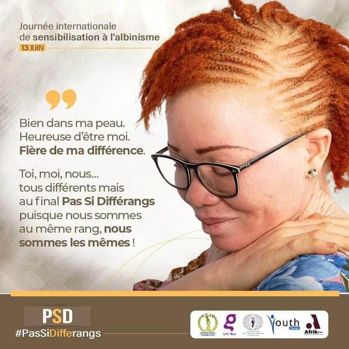 Bien dans ma peau. 
Heureuse d’être moi.
Fière de ma différence.

Toi, moi, nous… tous différents mais au final *Pas Si Differangs* puisque nous sommes au même rang, nous sommes les mêmes !

#PasSiDifferangs