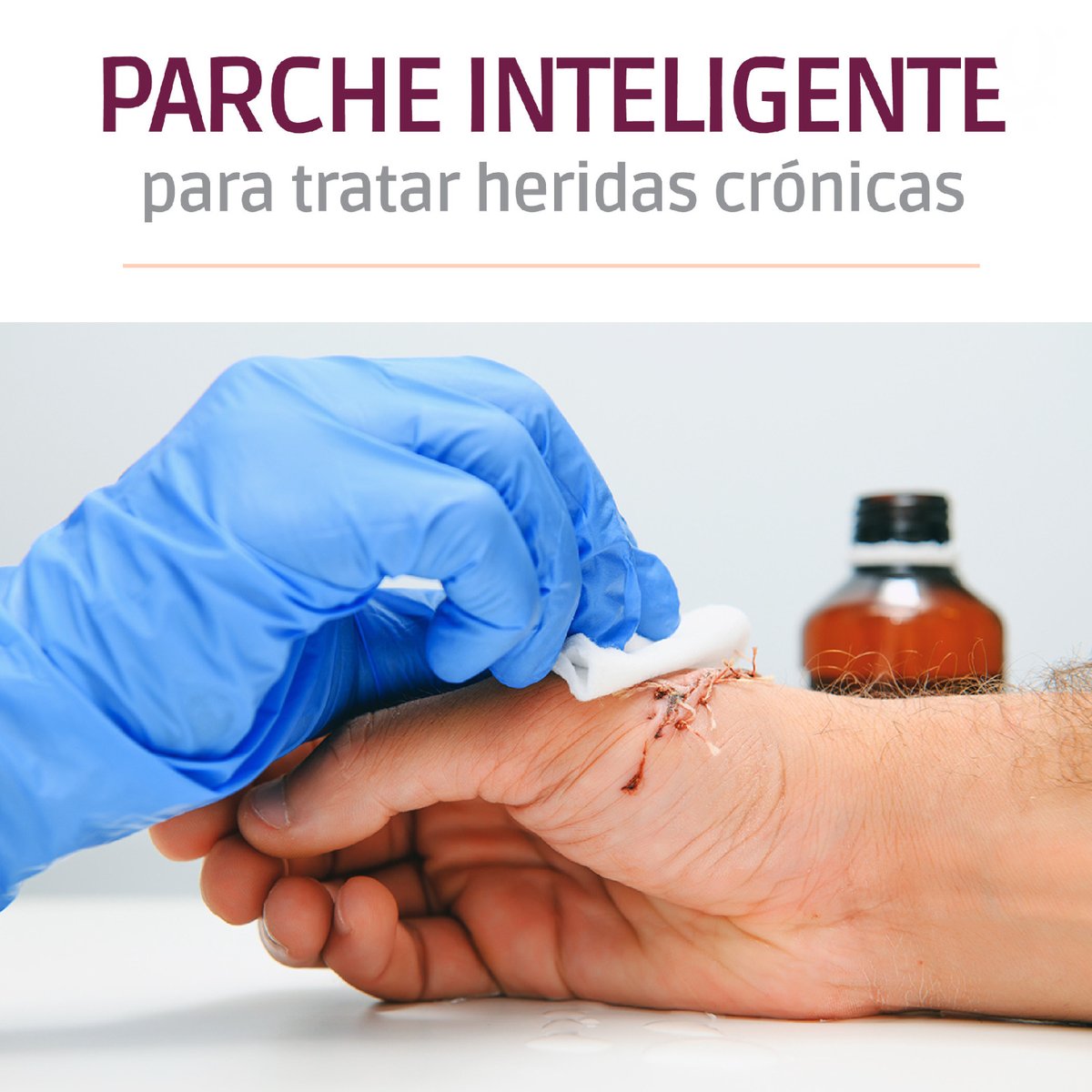 Una meta en el <a href="/IPN_MX/">IPN</a>  es que las investigaciones impacten en la calidad de vida de las personas. El desarrollo de Francisca Villanueva es ejemplo de ello: un parche inteligente para heridas crónicas que libera un antiséptico totalmente natural. 
acortar.link/9FcSpe