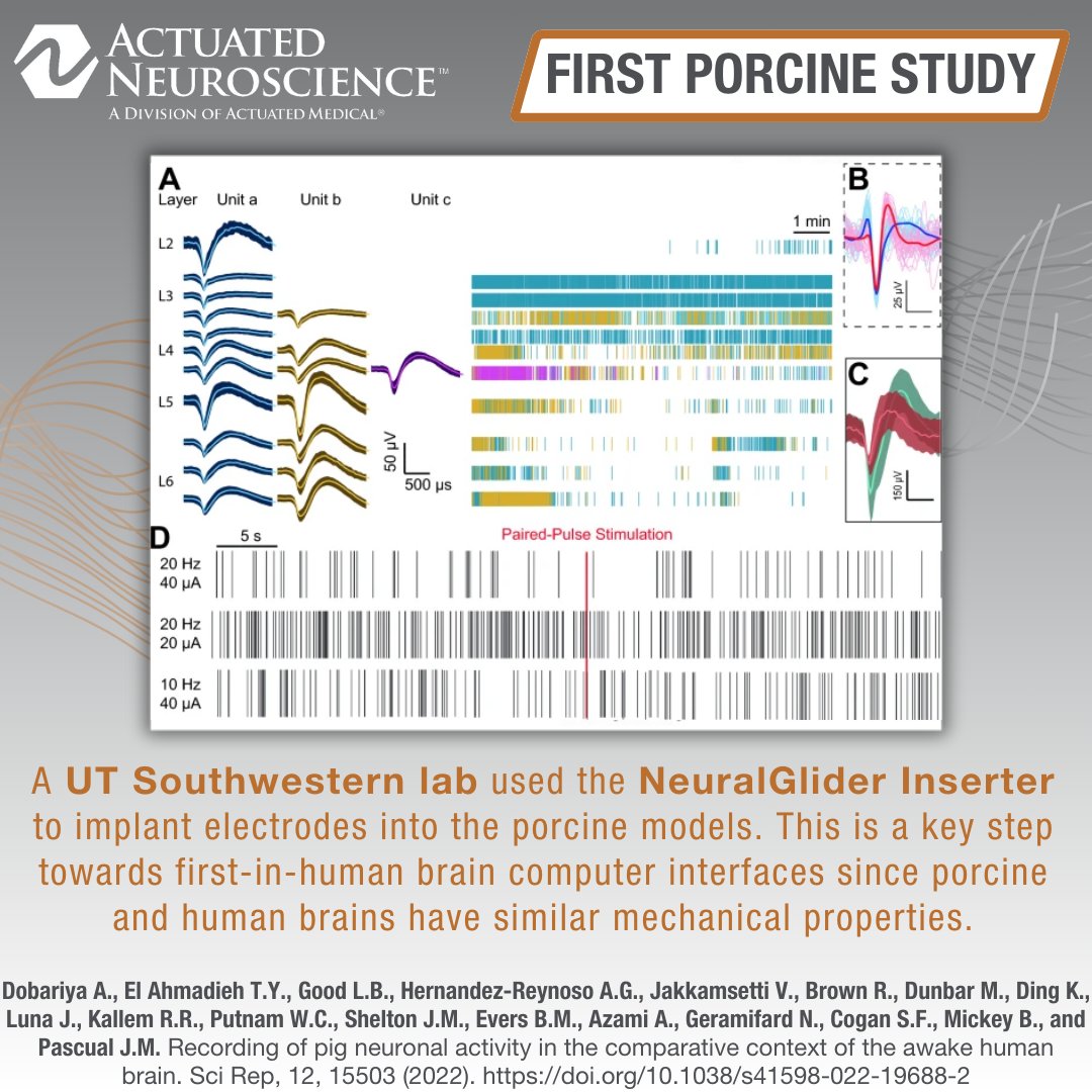 In this groundbreaking porcine study, the Pascual Lab at <a href="/UTSWMedCenter/">UT Southwestern Medical Center</a> implanted 8 µm penetrating electrodes into the brain using the NeuralGlider Inserter, enabling specific comparisons to human brain activity. 

bit.ly/3KEgo6a
