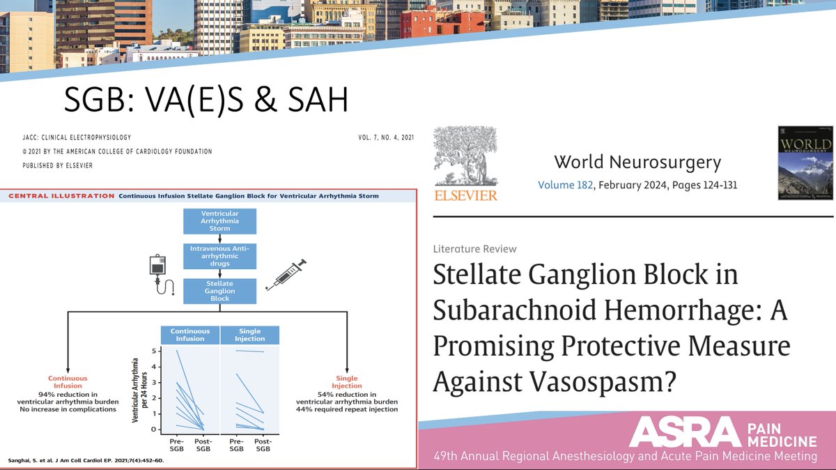 KalagaraHari's tweet photo. Jonny ... #Regionalanesthesia is Life Saving in ICU !!
Please Emphasize 💉 for 🫀&amp; 🧠also !!
I did the presentation on same topic @ASRA_Society #ASRAspring24 meeting. @RegionalAnaesUK @RenukaGeorge @nathanhwaldron @MayoAnesthesia @NarouzeMD @Ropivacaine @alexbstone @ESRA_Society https://t.co/S0RaYcXkpI