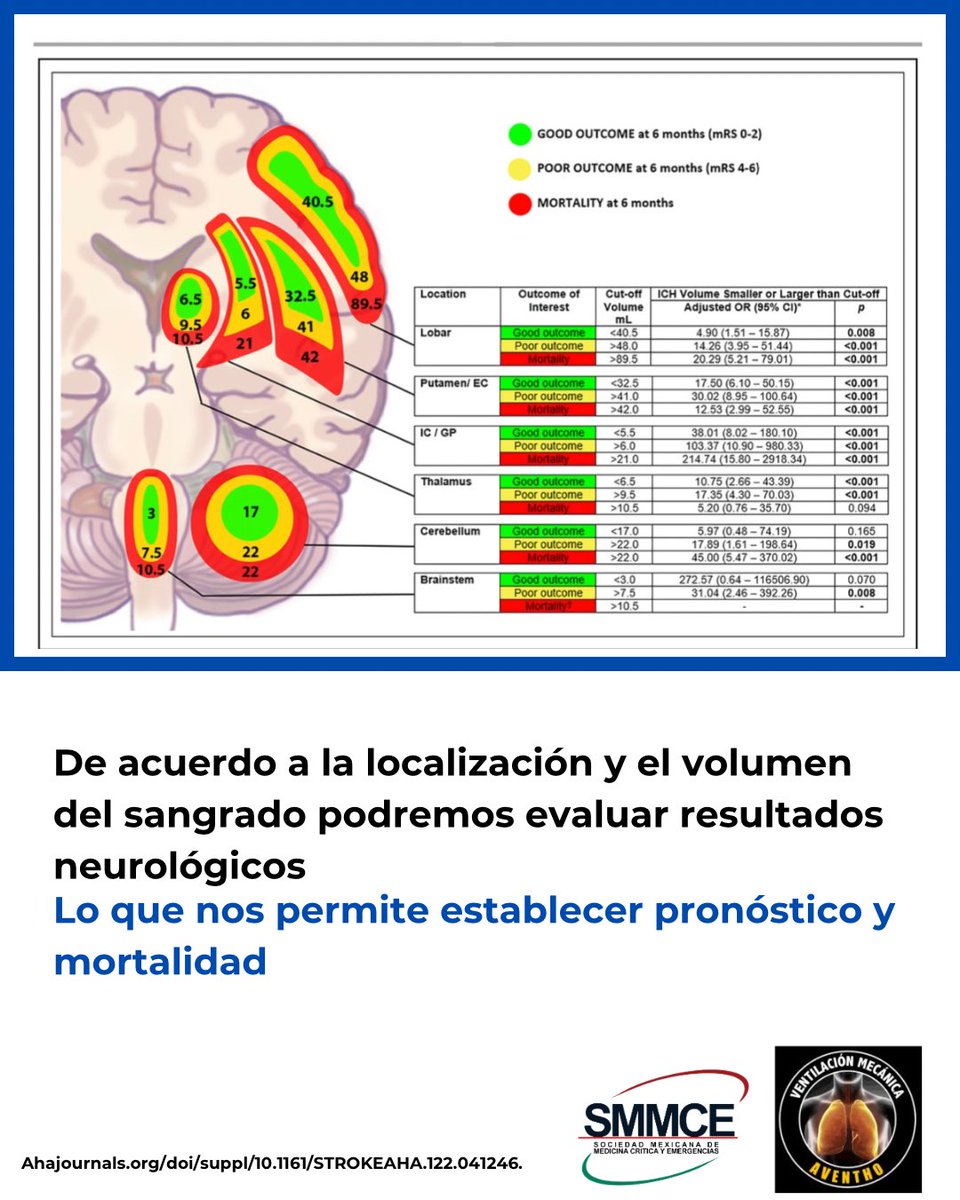 SMMCE_MX's tweet photo. Volumen del hematoma intracraneal https://t.co/6XnY8YAUug
