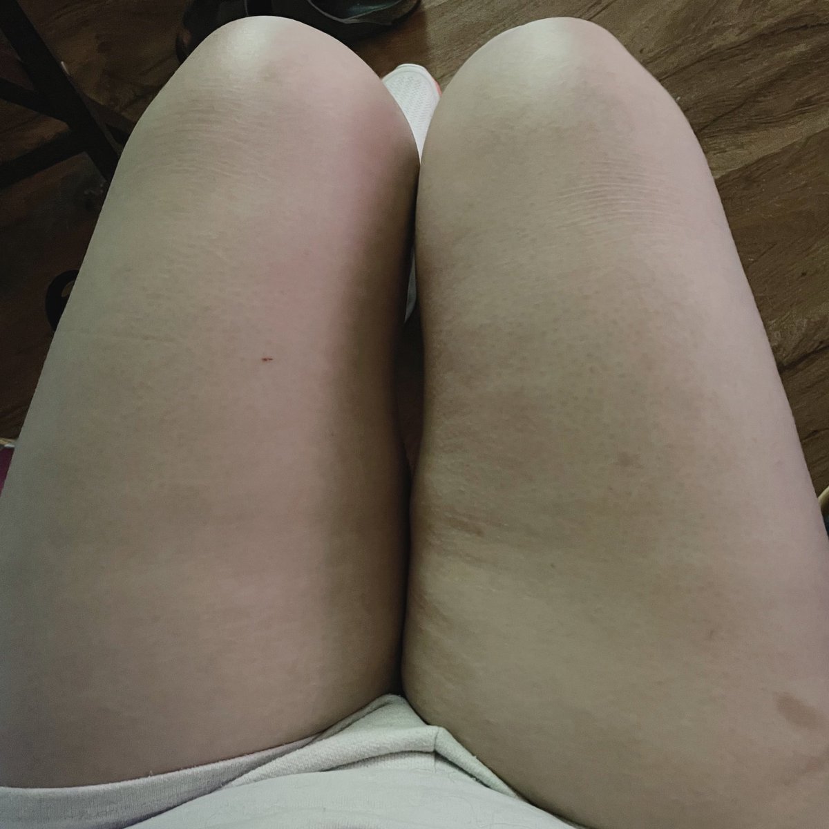buterakcals's tweet photo. 6 weeks later and i see no difference 👎🏻 https://t.co/gGK4a8upVz