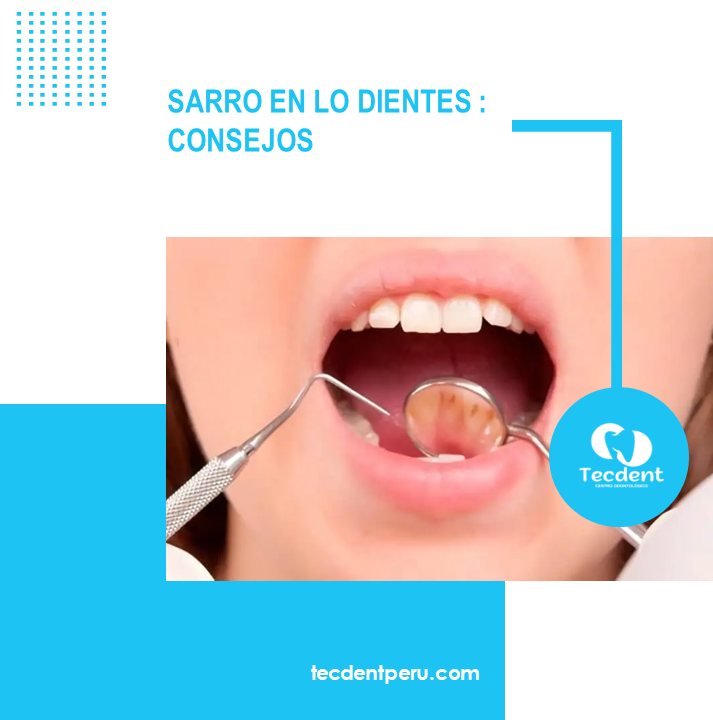 Tecdentperu's tweet photo. 📷El sarro no es ni más ni menos que la placa dental (una película pegajosa, incolora o amarillenta, compuesta principalmente de bacterias y restos de alimentos) que se ha endurecido en los dientes por el proceso de mineralización de la saliva. https://t.co/2Tig6EbJVe https://t.co/muQZKiqEe7