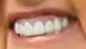 TinteroDMetztli's tweet photo. Tenemos entonces que la cara de asco se manifiesta, principalmente, por dos expresiones:
1.- La nariz se arruga en la parte alta y
2.- El labio superior asciende...sí, a pesar del bótox. 👇 https://t.co/yA0USI0TEO
