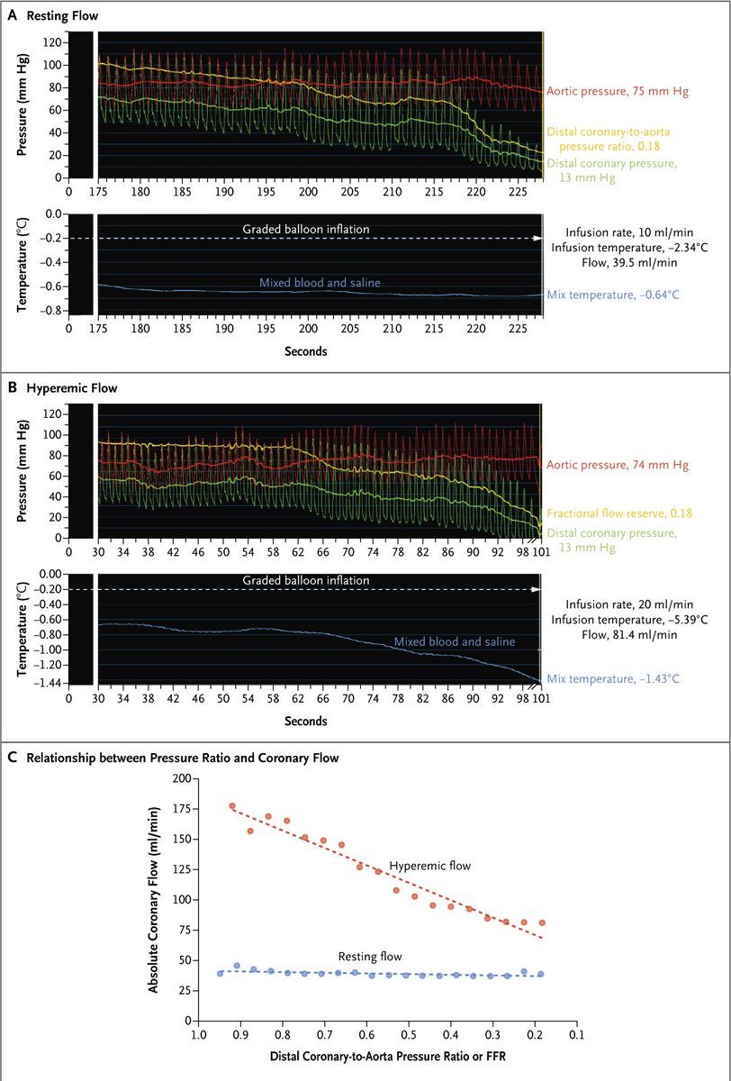 Correspondence: Coronary-Artery Autoregulation with Increasing Stenosis nej.md/4e7Esf0