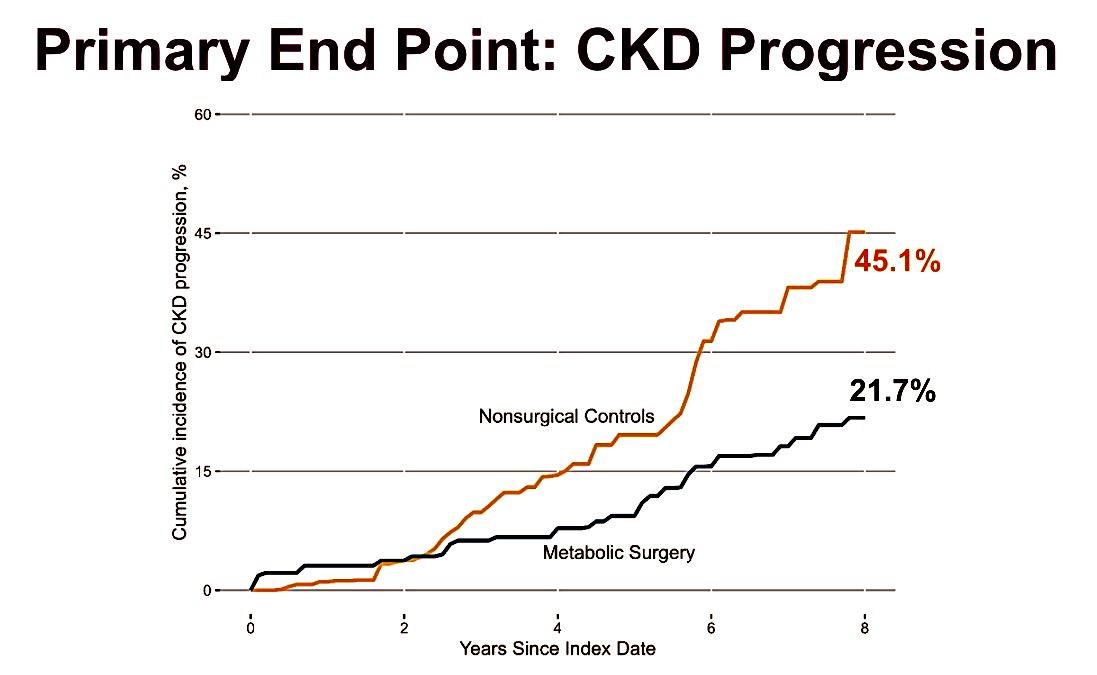 Ali_Aminian_MD's tweet photo. Bariatric Surgery 🆚 GLP1-RA to Protect Failing Kidneys

https://t.co/av8pXySnnM
#ASMBS2024 https://t.co/rozxbpa5Rs
