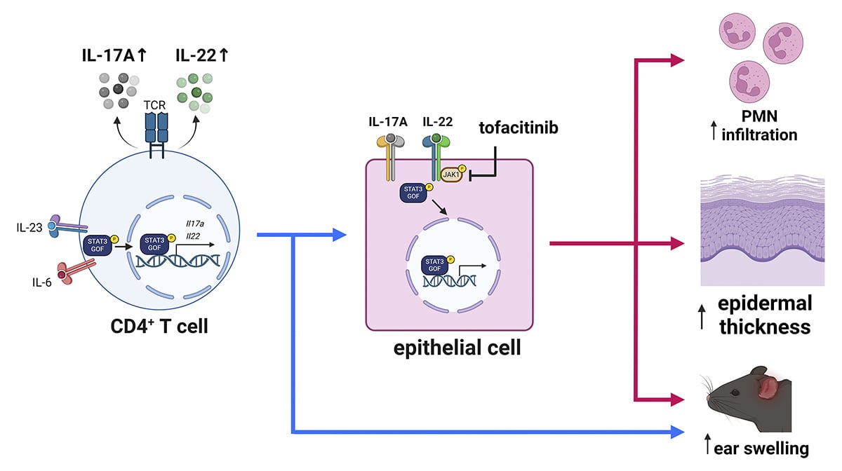 Rockefeller U. Press (@rockupress) on Twitter photo In <a href="/JExpMed/">Journal of Experimental Medicine</a>, Toth et al. @MACattackLab <a href="/WUSTLmed/">Test Account</a> report spontaneous and stimulus-driven skin disease in a mouse model associated w/ locally increased Th17 that is partially dependent on IL-22 signaling hubs.la/Q02BpZNR0
#autoimmunity #immunodeficiency #inflammation In <a href="/JExpMed/">Journal of Experimental Medicine</a>, Toth et al. @MACattackLab <a href="/WUSTLmed/">Test Account</a> report spontaneous and stimulus-driven skin disease in a mouse model associated w/ locally increased Th17 that is partially dependent on IL-22 signaling hubs.la/Q02BpZNR0
#autoimmunity #immunodeficiency #inflammation
