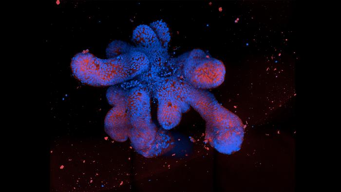 Lab-Grown "Mini-Guts" Link Crohn's Disease Severity to Epigenetic Changes

Researchers say intestinal epithelial organoids could in future be used to tailor Crohn’s disease treatment to individual patients. Learn more: ow.ly/js3l50Sg3bu