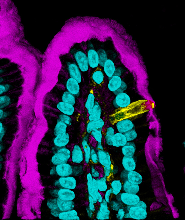 Enjoying a science filled #TuftTuesday

#pathart #histoart #sciart #bioart #microscopy #intestine
