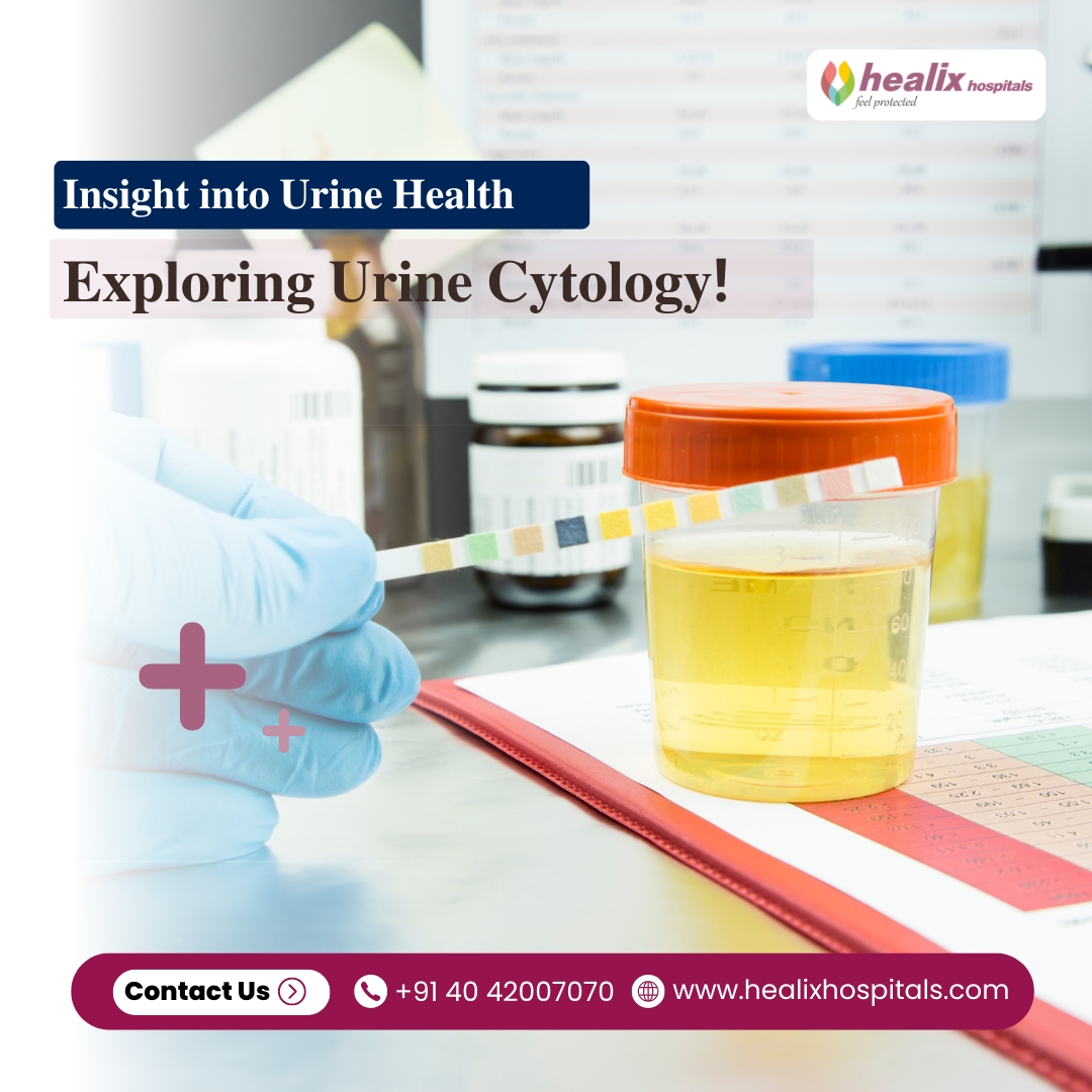 HealixHospitals's tweet photo. š§ Dive into the world of #urinecytology, a diagnostic test that examines urine samples for #abnormalcells. Whether screening for #urinarytractinfections or detecting early signs of cancer, urine cytology plays a crucial role in maintaining urinary health. š§
#HealixHospitals https://t.co/RUWzq5yF2M