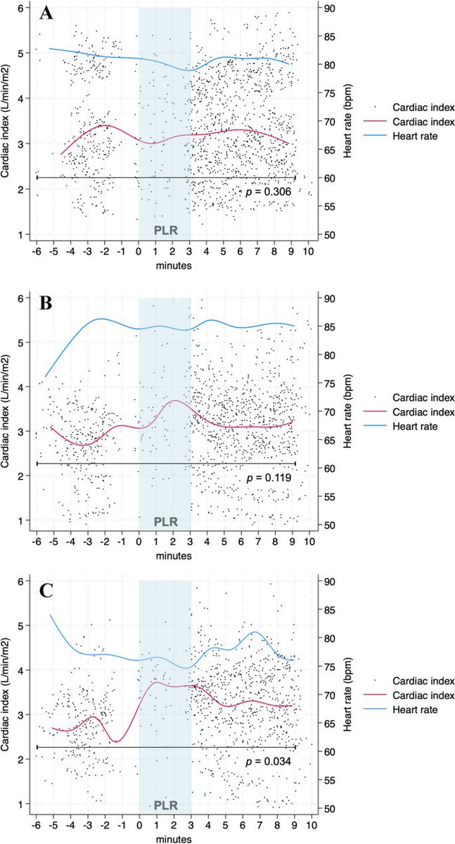 Hemodynamic effects of passive leg raising (PLR) in mechanically ventilated ICU patients during fluid removal.

link.springer.com/article/10.100…

by R castro, <a href="/AndromedaShock/">ANDROMEDA-SHOCK</a> et al. 🇨🇱