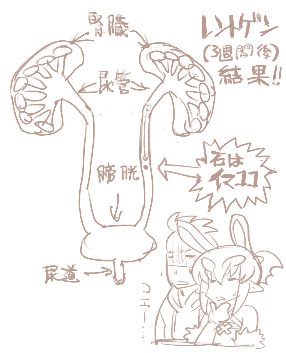 尿路結石3週間目の進捗です! 