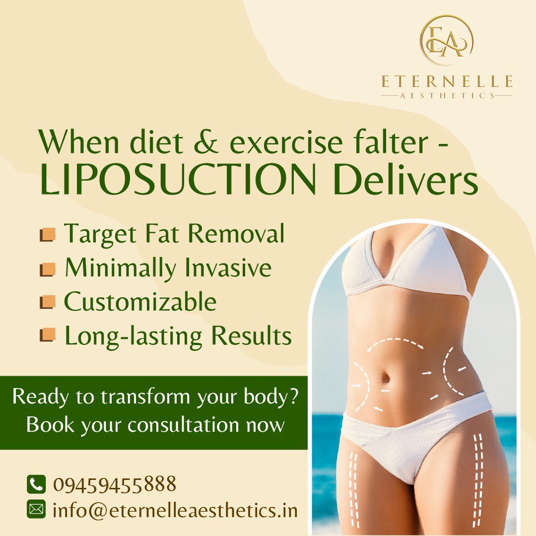 Eternelle_'s tweet photo. When diet and exercise alone don't yield the desired results, #liposuction can deliver the transformation you seek.

Book now 👇🏻
📲094594 55888
📧info@eternelleaesthetics.in
🌐https://t.co/dQ80mZgIVF

#liposuctionsurgery #unwantedbodyfat #drdeepthidevarakonda #eternelleaesthetics https://t.co/8qdAVZWuxe