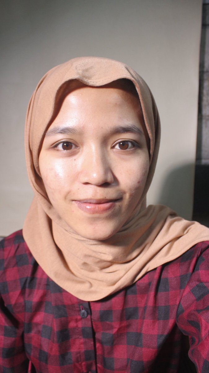 ellsstari's tweet photo. Kalau kalian merasa kulit kalian gradakan banget, banyak komedo, kulit berasa kasar. Kalian butuh banget yang namanya exfoliasi. https://t.co/ZaugQqd0gN