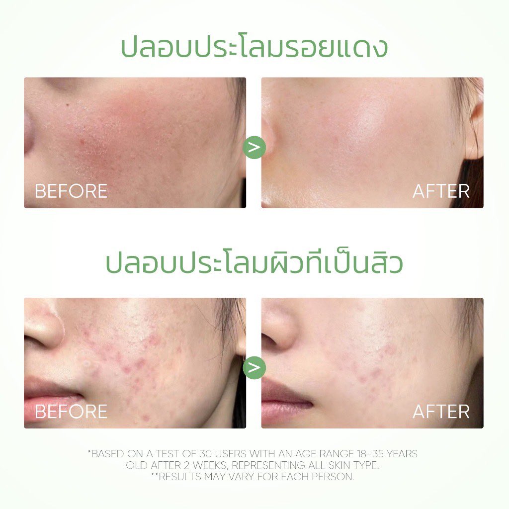 PSananthachat's tweet photo. ￼SKINTIFIC Mugwort มาส์กโคลนแบบแท่งที่ช่วยต้นสิว 40g（ลดรอยแดง ลดการอักเสบ ที่ช่วยลดรูขุมขนและสิว）มาสก์หน้า มาสก์โคลน 

พิกัด https://t.co/zhJTV9EIy8 https://t.co/ar1r99DwPI