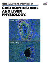 #APSselect mouse study from @AJPGI identifies a receptor that helps the intestines recover from radiation-induced injury: ow.ly/Hvgy50S9Z94