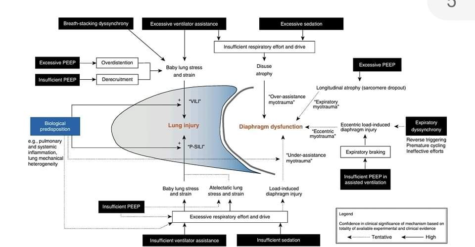 LeslieMegom's tweet photo. 🔰Ventilación protectora de los pulmones y el diafragma🫁▪️◾️▪️◾️
👇🏽👇🏽👇🏽👇🏽👇🏽👇🏽
https://t.co/eZ4sz3uAl3
🗝🔓
https://t.co/sMMJ8bYfPH https://t.co/EQ5aLZFeqz