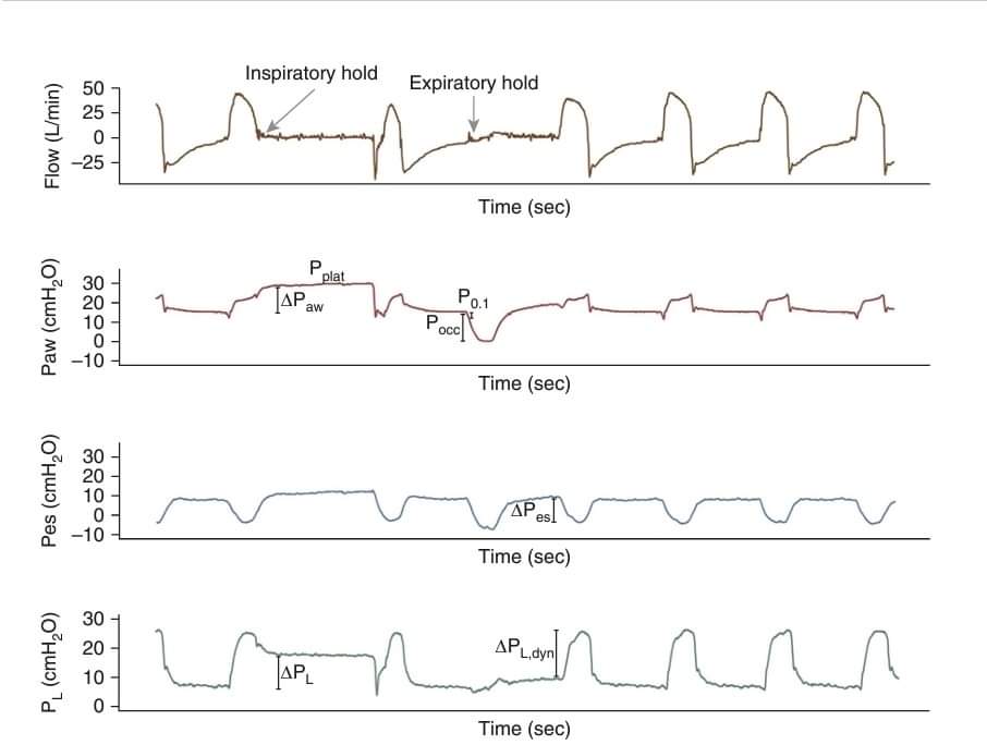 LeslieMegom's tweet photo. 🔰Ventilación protectora de los pulmones y el diafragma🫁▪️◾️▪️◾️
👇🏽👇🏽👇🏽👇🏽👇🏽👇🏽
https://t.co/eZ4sz3uAl3
🗝🔓
https://t.co/sMMJ8bYfPH https://t.co/EQ5aLZFeqz