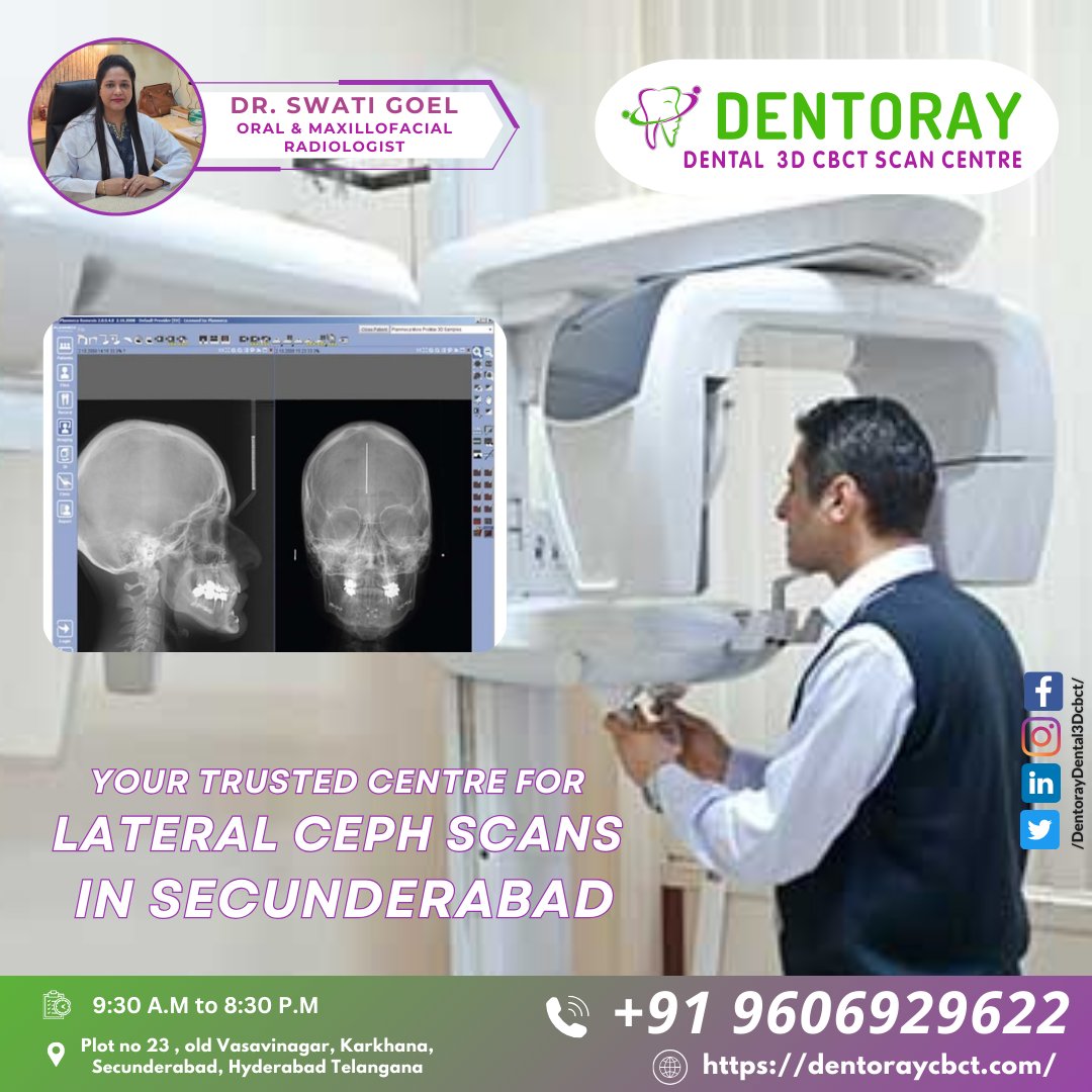 dentoray3dscan's tweet image. 🔹 #LateralCEPH
🔹 #PreciseImaging
🔹 #DentalDiagnosis
🔹 #Secunderabad
🔹 #TopQualityScans
🔹 #AdvancedImaging
🔹 #OralRadiology
🔹 #DentorayCBCT
🔹 #3DCBCTScan
🔹 #LateralCEPHScan
🔹 #BestDentalScan
🔹 #DrSwatiGoel
🔹 #DentalXRay
🔹 #RadiologyExperts
🔹 #QuickResults