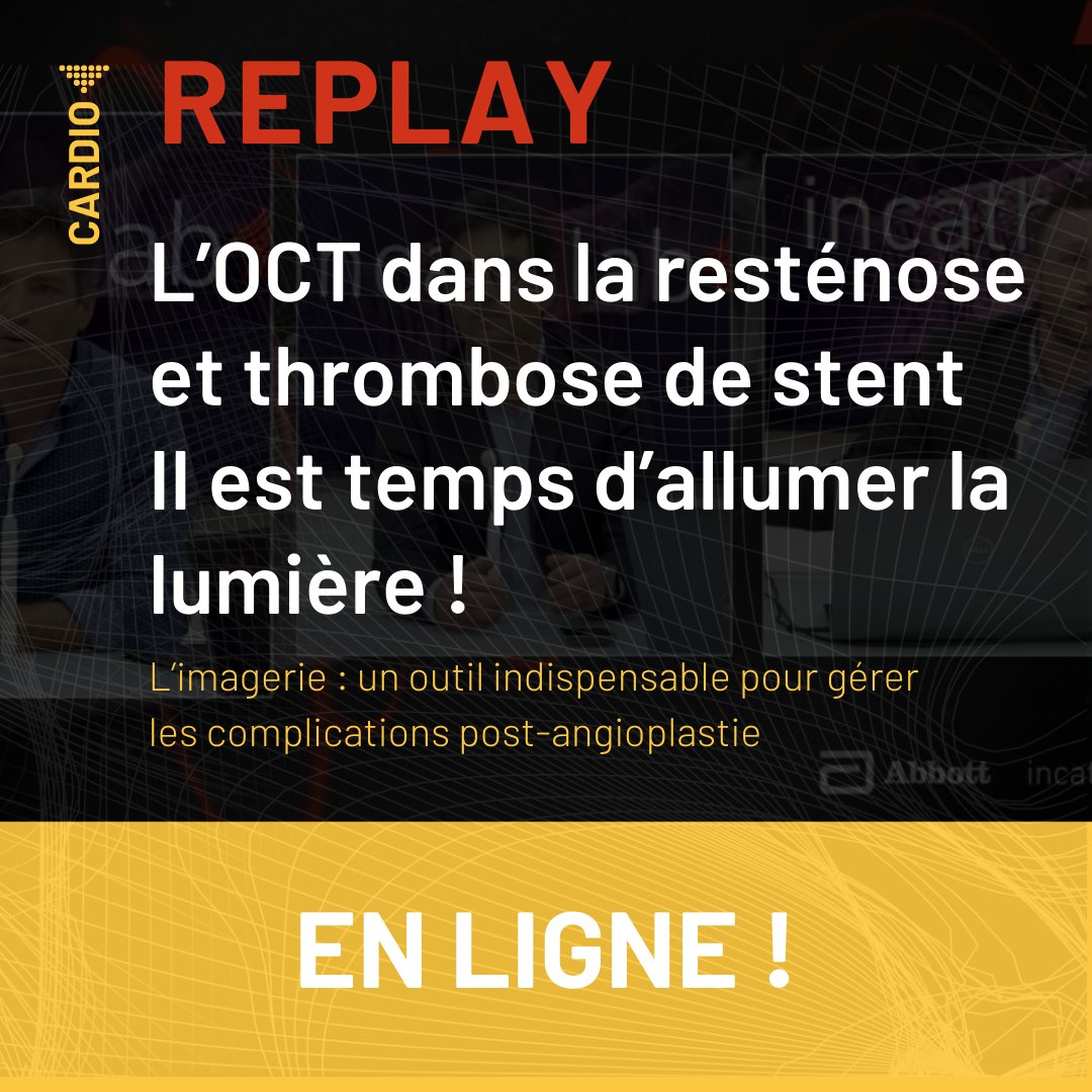 Revivez notre table ronde sur l’#OCT dans la resténose et thrombose de stent. Il est temps d’allumer la lumière ! 💡 L'imagerie est un outil indispensable pour gérer les complications post-angioplastie.
👉 swll.to/dKgp4

<a href="/SouteyrandG/">Souteyrand Geraud</a>, <a href="/BouchouGael/">Gael BOUCHOU</a>

#Imagerie