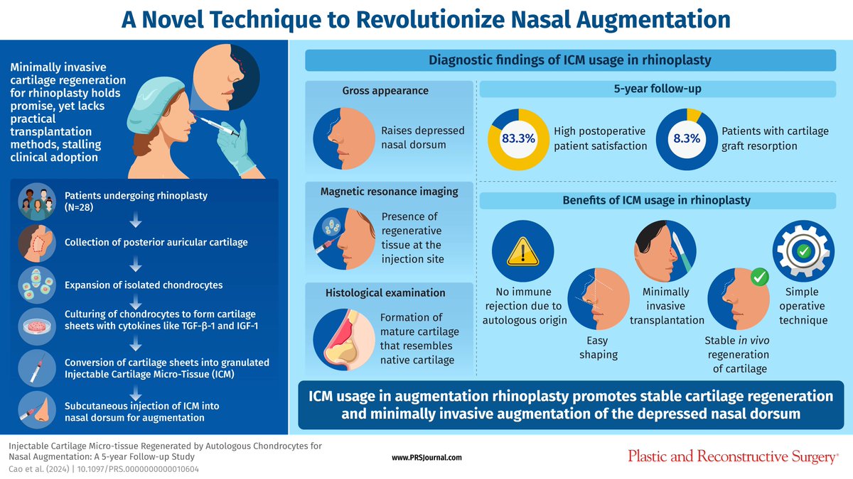 prsjournal's tweet photo. Discover how this @prsjournal study introduces a minimally invasive solution with promising outcomes for augmentation rhinoplasty! Find out more here: https://t.co/7rmOmuKESJ
#PlasticSurgery #PlasticAndReconstructiveSurgery #AugmentationRhinoplasty #InjectableCartilage #ICM https://t.co/QPjLExiQwR