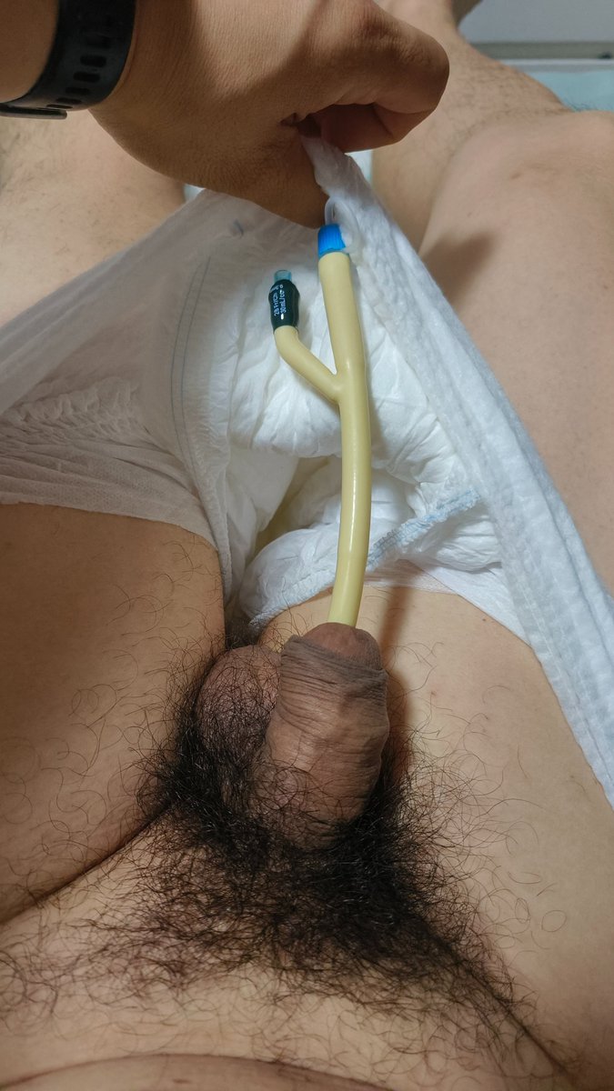 bobolp01's tweet photo. fr28 catheter is too big https://t.co/oe1pYtM6Gq