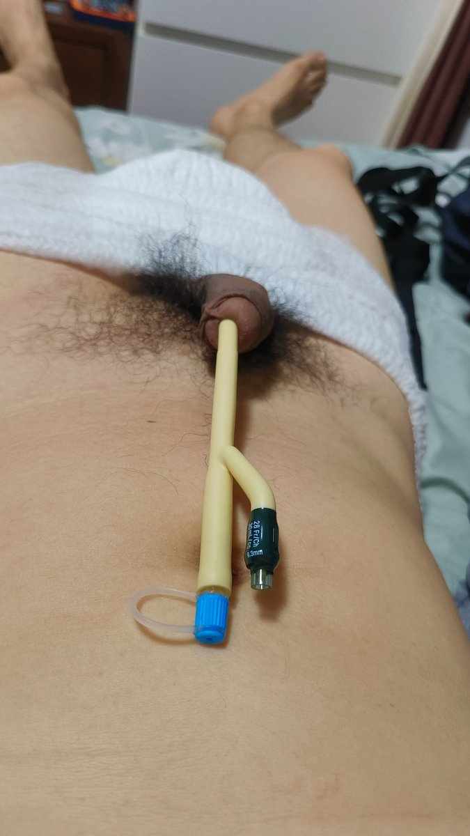 bobolp01's tweet photo. fr28 catheter is too big https://t.co/oe1pYtM6Gq