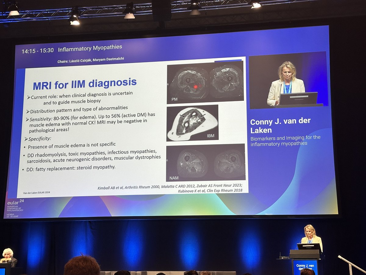 eular_ARD's tweet photo. Dr van der Laken from @amsterdamumc showed data on imaging in #myositis
- MRI useful for differential diagnosis, biopsy site, and monitoring treatment response
- ultrasound less sensitive
- PET still to be validated but useful for screening of malignancy
#EULAR2024
MP https://t.co/w1MODpGPLK