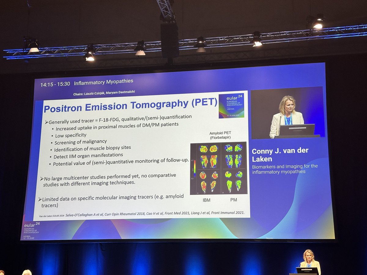 eular_ARD's tweet photo. Dr van der Laken from @amsterdamumc showed data on imaging in #myositis
- MRI useful for differential diagnosis, biopsy site, and monitoring treatment response
- ultrasound less sensitive
- PET still to be validated but useful for screening of malignancy
#EULAR2024
MP https://t.co/w1MODpGPLK