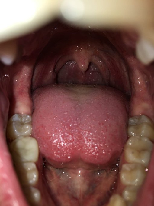 For you 💕 #mouth #mouthfetish #uvula #throat https://t.co/5rTsvwuxhU<a href="/tag/mouth"class="tags">#mouth</a><a href="/tag/mouthfetish"class="tags">#mouthfetish</a><a href="/tag/uvula"class="tags">#uvula</a><a href="/tag/throat"class="tags">#throat</a>