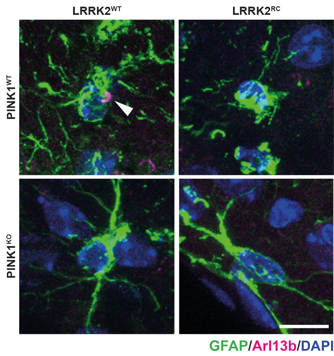 mrcppu's tweet photo. New @ASAP_Research study on #LRRK2 and #PINK1 in the brain with @miratul_neuro,Dario Alessi @mrcppu,@pfeffersuzanne,@LRRK2_central. Studies point to a convergent mechanism in #Parkinsonsdisease whereby ciliogenesis signalling is disrupted in the striatum. https://t.co/D2GOgWmRVV https://t.co/7fCx31hXtM