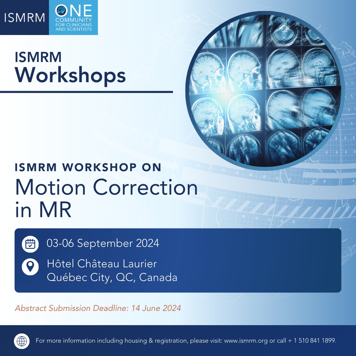 ISMRM's tweet photo. WORKSHOP WEDNESDAY:
ISMRM Workshop on Motion Correction in MR abstract submission deadline THIS FRIDAY!

Submit your abstracts &amp; stipend applications by 14 June 2024 at 25:59 UTC: https://t.co/jlrspvtwa5

#ISMRM #ISMRT #MRI #MagneticResonance #MR #Radiology #MedicalImaging https://t.co/Nse3K5K0ts