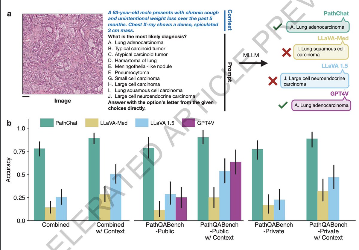 Eric Topol (@erictopol) on Twitter photo PathChat, the most advanced multimodal #AI for pathology, just published <a href="/Nature/">nature</a>
nature.com/articles/s4158…
by <a href="/AI4Pathology/">Faisal Mahmood</a> <a href="/MYLu97/">Max Lu</a> <a href="/chenbowen118/">Bowen Chen</a> @DFKW_MD and colleagues
free access rdcu.be/dKC0r PathChat, the most advanced multimodal #AI for pathology, just published <a href="/Nature/">nature</a>
nature.com/articles/s4158…
by <a href="/AI4Pathology/">Faisal Mahmood</a> <a href="/MYLu97/">Max Lu</a> <a href="/chenbowen118/">Bowen Chen</a> @DFKW_MD and colleagues
free access rdcu.be/dKC0r