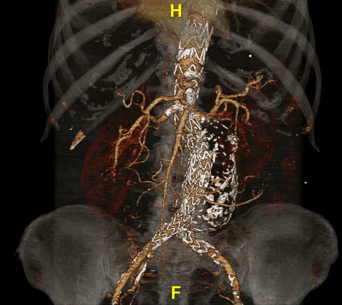 John Landau tweet media