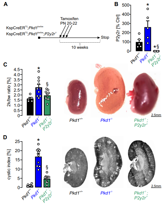 JASN_News's tweet photo. ADPKD is characterized by multiple bilateral kidney cysts which gradually enlarge, resulting in a decline in kidney function. This study found P2Y2R was significantly expressed in human and mouse polycystic kidneys https://t.co/WP8oV1B9tT

@LEIP1 https://t.co/MAOzrBrM5s