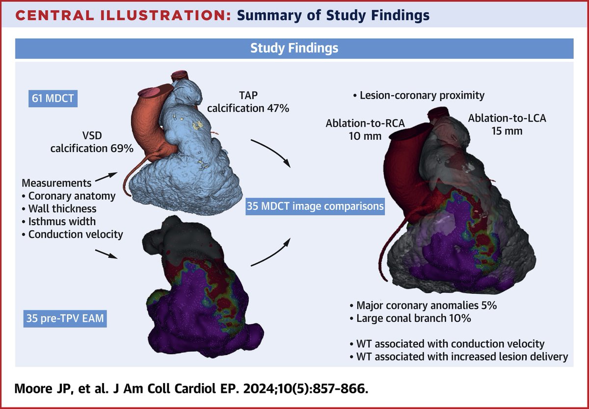JACC Journals (@jaccjournals) on Twitter photo MDCT identifies anatomical structures relevant to catheter ablation for repaired tetralogy of Fallot. Wall thickness at commonly targeted anatomical VT isthmuses is assoc w/ functional isthmus properties & ⬆️ thermal energy delivery bit.ly/45tu8u8
#JACCCEP <a href="/shivkumarmd/">Kalyanam Shivkumar MD PhD</a> MDCT identifies anatomical structures relevant to catheter ablation for repaired tetralogy of Fallot. Wall thickness at commonly targeted anatomical VT isthmuses is assoc w/ functional isthmus properties & ⬆️ thermal energy delivery bit.ly/45tu8u8
#JACCCEP <a href="/shivkumarmd/">Kalyanam Shivkumar MD PhD</a>
