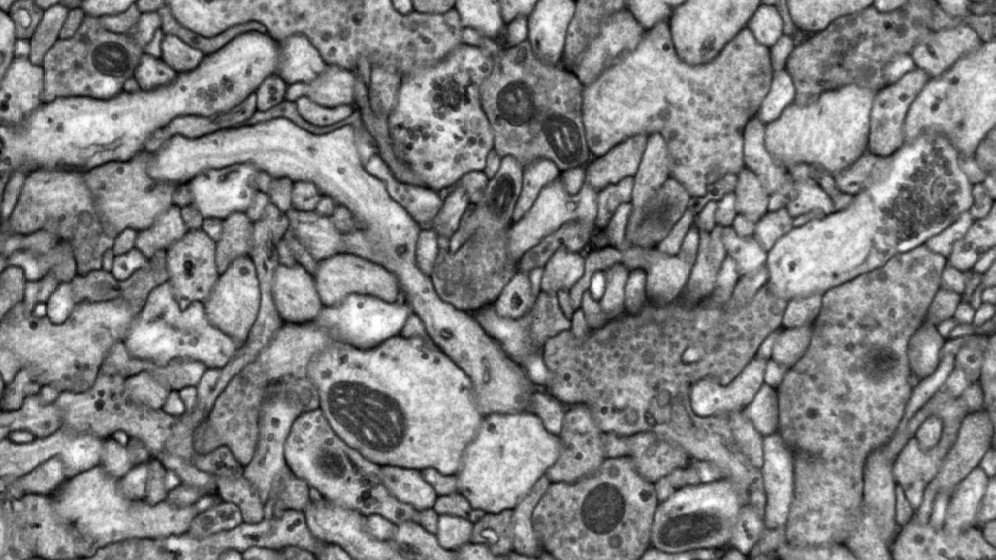 Michael Winding (@windingmichael) on Twitter photo First electron microscopy image from the lab! 🎉
You are seeing hundreds of individual neurons from the brain of a fruit fly larva.
Great work from Anna Seggewisse and Chris Peddie, <a href="/EM_STP/">Emy St-pierre</a> First electron microscopy image from the lab! 🎉
You are seeing hundreds of individual neurons from the brain of a fruit fly larva.
Great work from Anna Seggewisse and Chris Peddie, <a href="/EM_STP/">Emy St-pierre</a>