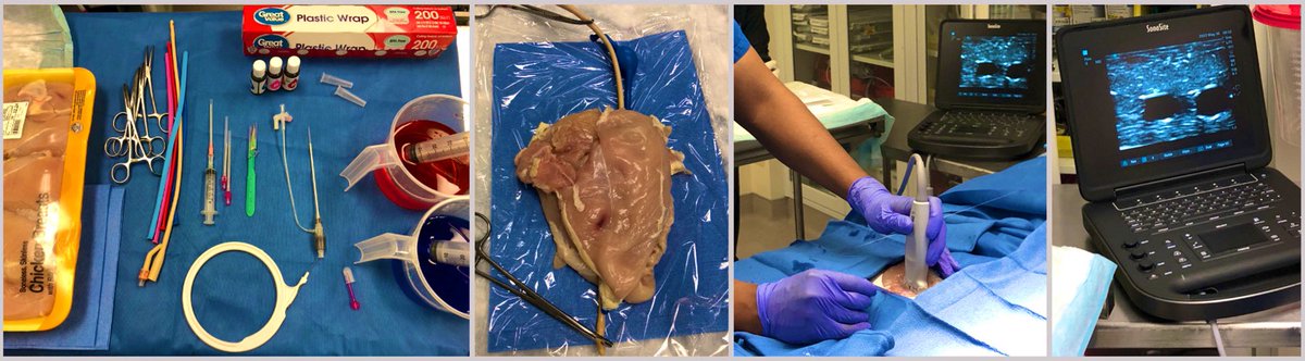 Got LOTS of questions about how to set this up when we trialed it in lab. Finally sharing here so others can adapt and use for their own vascular sim purposes! 🐓🐓🐓🐓🐓🐓🐓🐓🐓🐓🐓🐓
<a href="/WashUVascular/">WashU Medicine Division of Vascular Surgery</a> @WashUSurgRes <a href="/westleyohman/">Westley Ohman</a> 

 sciencedirect.com/science/articl…