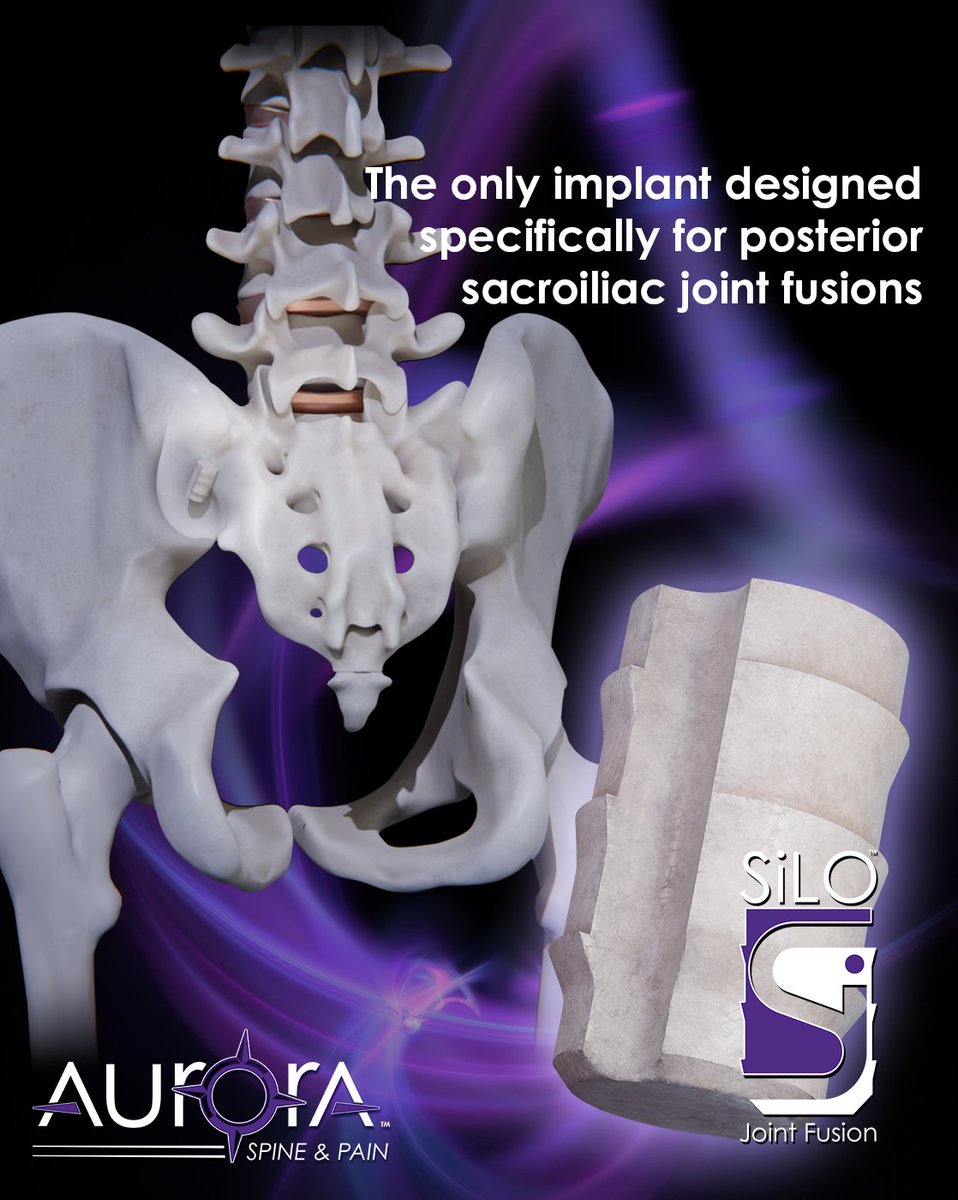 AuroraSpine's tweet image. SiLO™, a single implant Posterior Si-Fusion System made of human cortical bone. With a simple &amp;amp; safe procedure of stabilizing and fusing the Sacroiliac Joint.

#sijointfusion #SiLOallograft #simpleandsafe #78