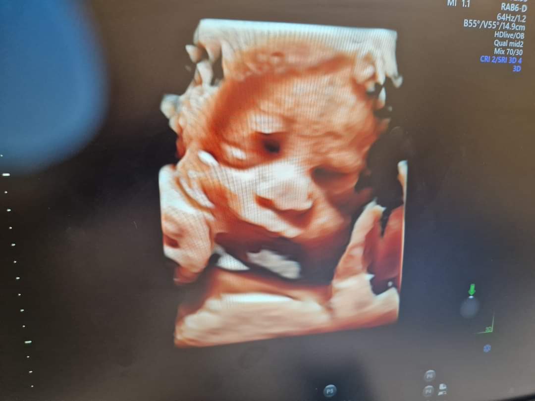 JenThePoob's tweet photo. @foofighters I'm sneaking in your smallest fan on the 15th 🥳 am so excited! Xxx https://t.co/nBpWwWiMNA