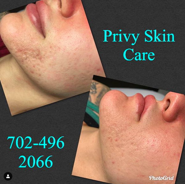Privy Skin Care tweet media