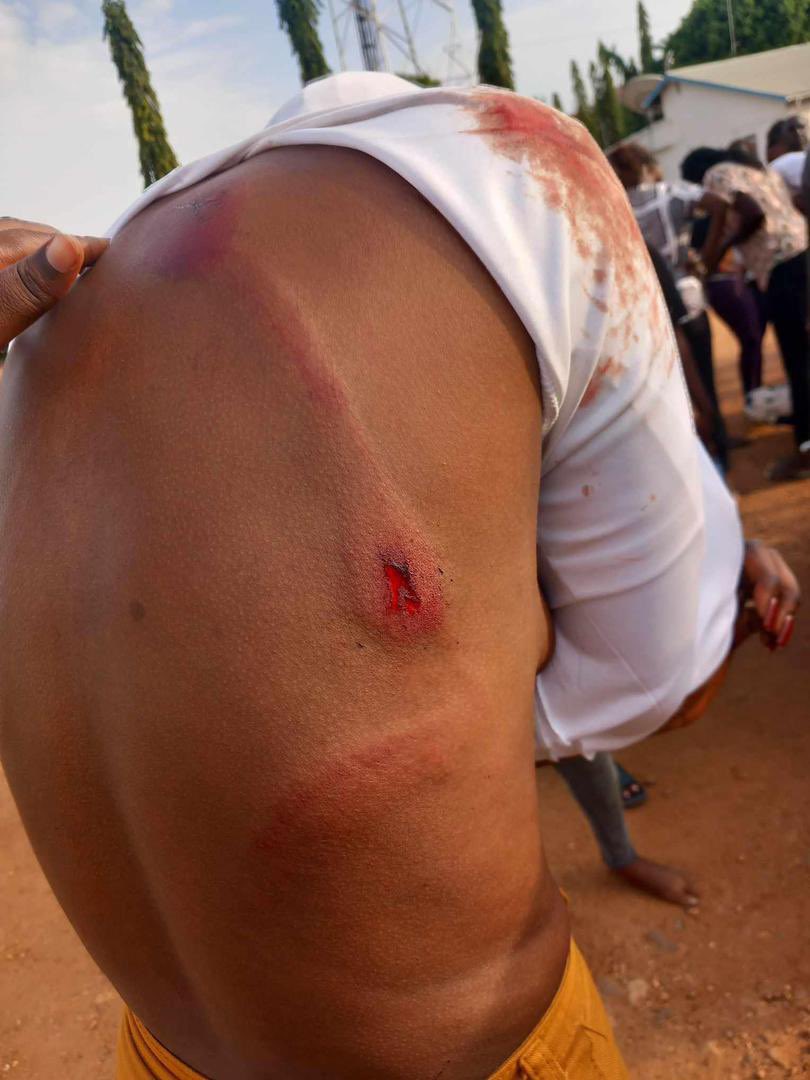 JacklineNasiwa's tweet photo. In a country with low literacy &amp; high illiteracy amongst women &amp; girls, amidst economic hardship, the police in South Sudan brutally and mercilessly evict, beat and torture girls at Uni of Juba for not paying hostel fees. Protect girls &amp;women from all forms of GBV, respect ROL. https://t.co/gcycfwY5Xz