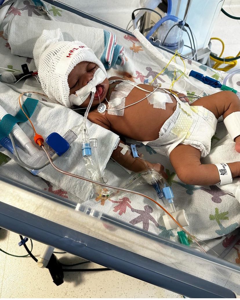 therealyaacki's tweet photo. PLEASE REPOST MY NIECE STORY YALL PLEASE ! OAKLAND CHILDREN HOSPITAL IS SLOWLY KILLING MY NIECE ! https://t.co/7Flsd5ZFmJ
