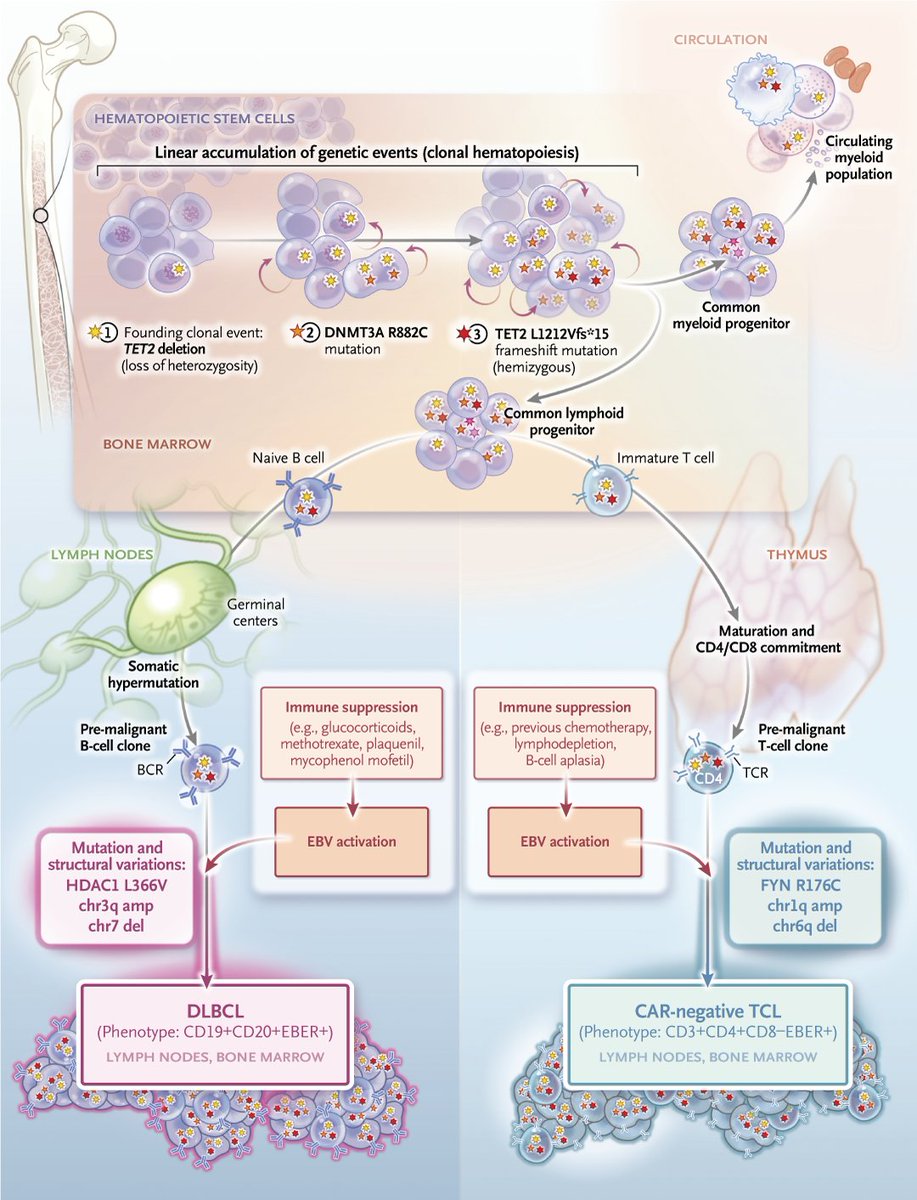 NEJM's tweet photo. Second tumors after CAR T-cell therapy are rare, and in one case of a secondary T-cell lymphoma, detailed analysis showed that the genetic construct that was used to make the CAR T cells was unrelated to the second tumor. Read the full study results: https://t.co/mxGSRyPgV2 https://t.co/m9J4BKAgNx