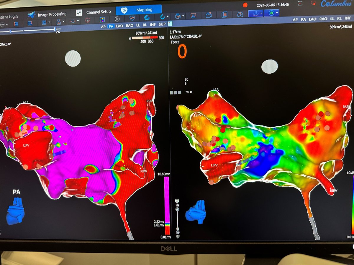 Microport EP tweet media